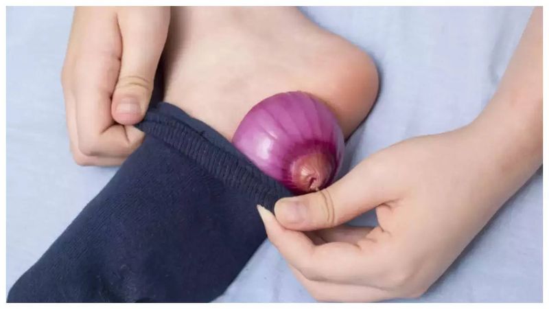 Onions in Socks